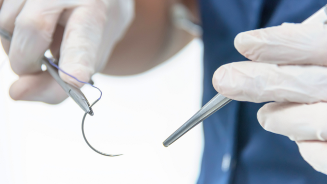 sutures 1