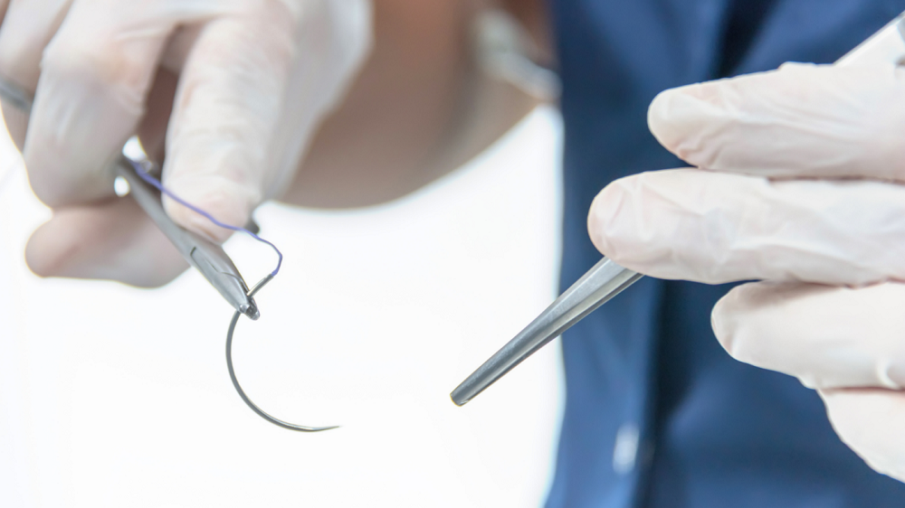 sutures 1
