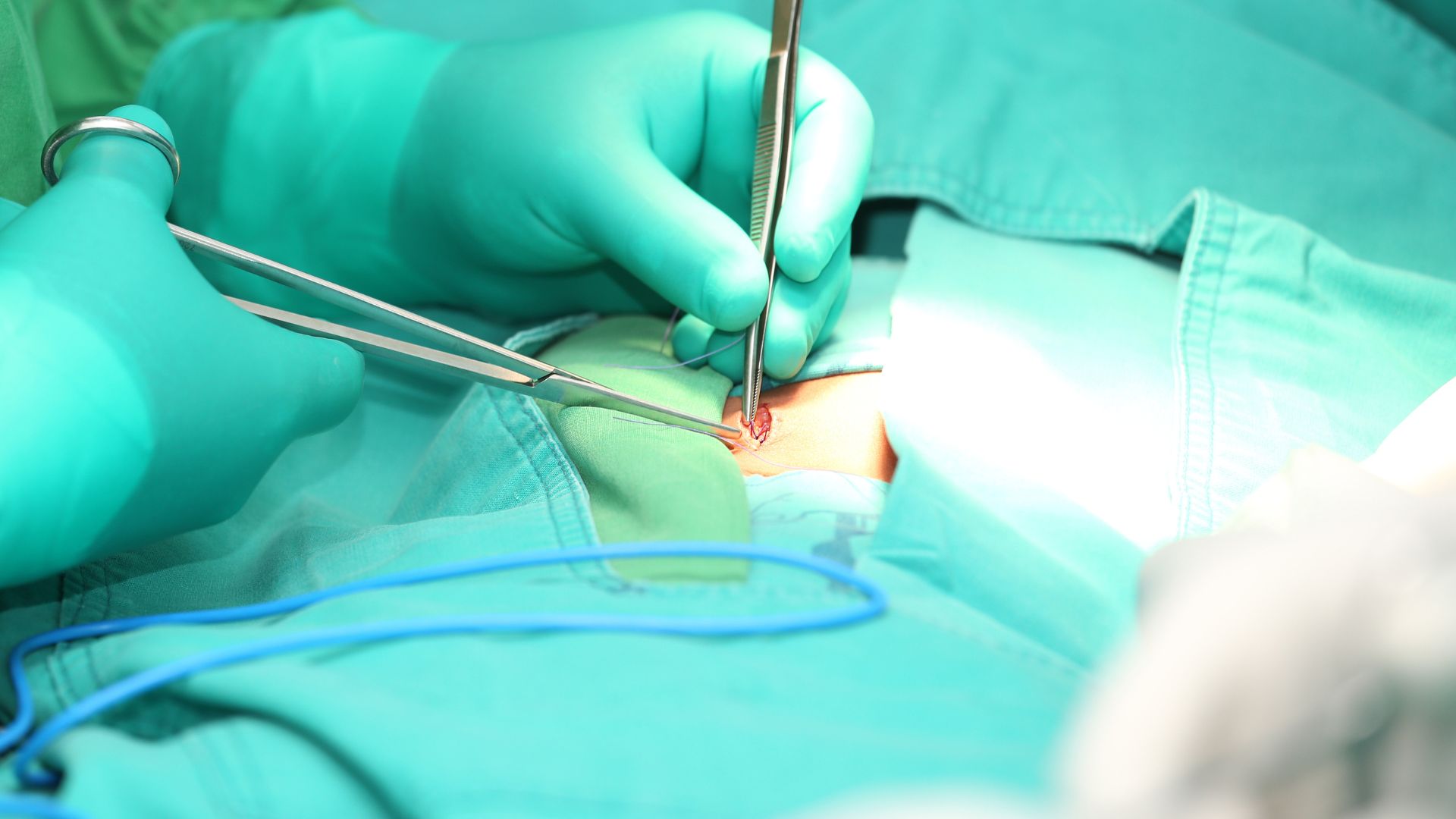 Sutures absorbables