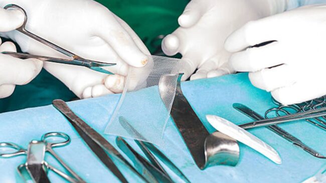filet herniaire
