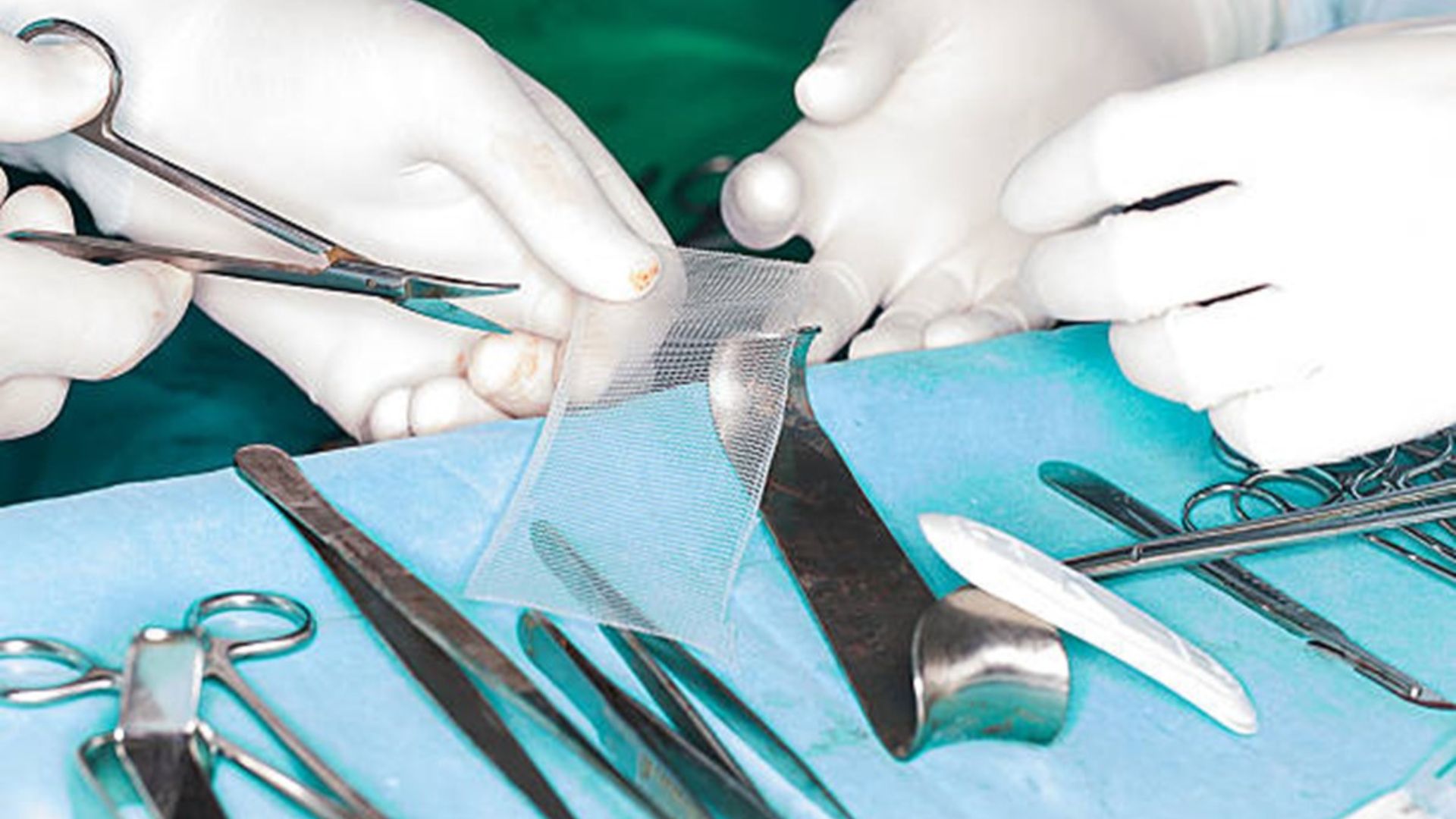 filet herniaire