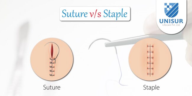 Suture ou agrafe
