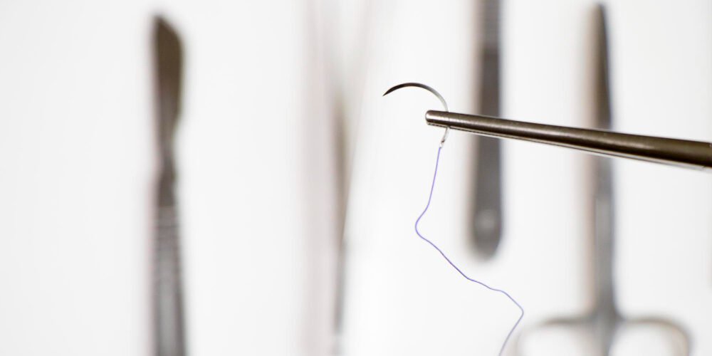 What Type of Suture Is Used to Close Skin